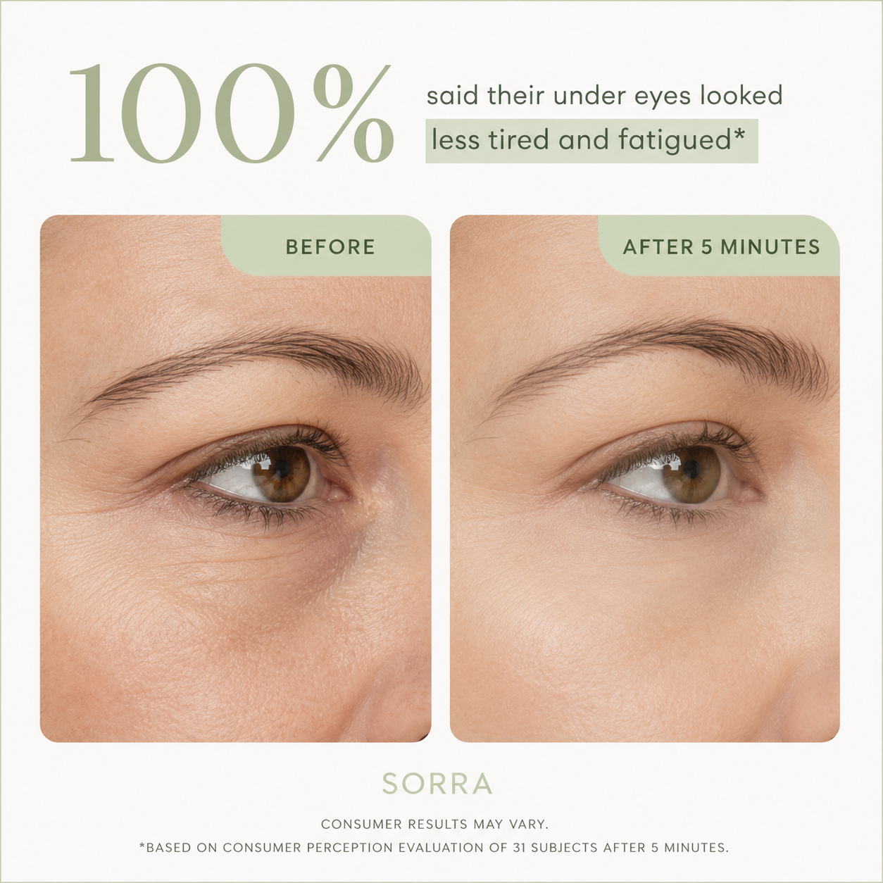 Sorra™ Eye Bag Eraser