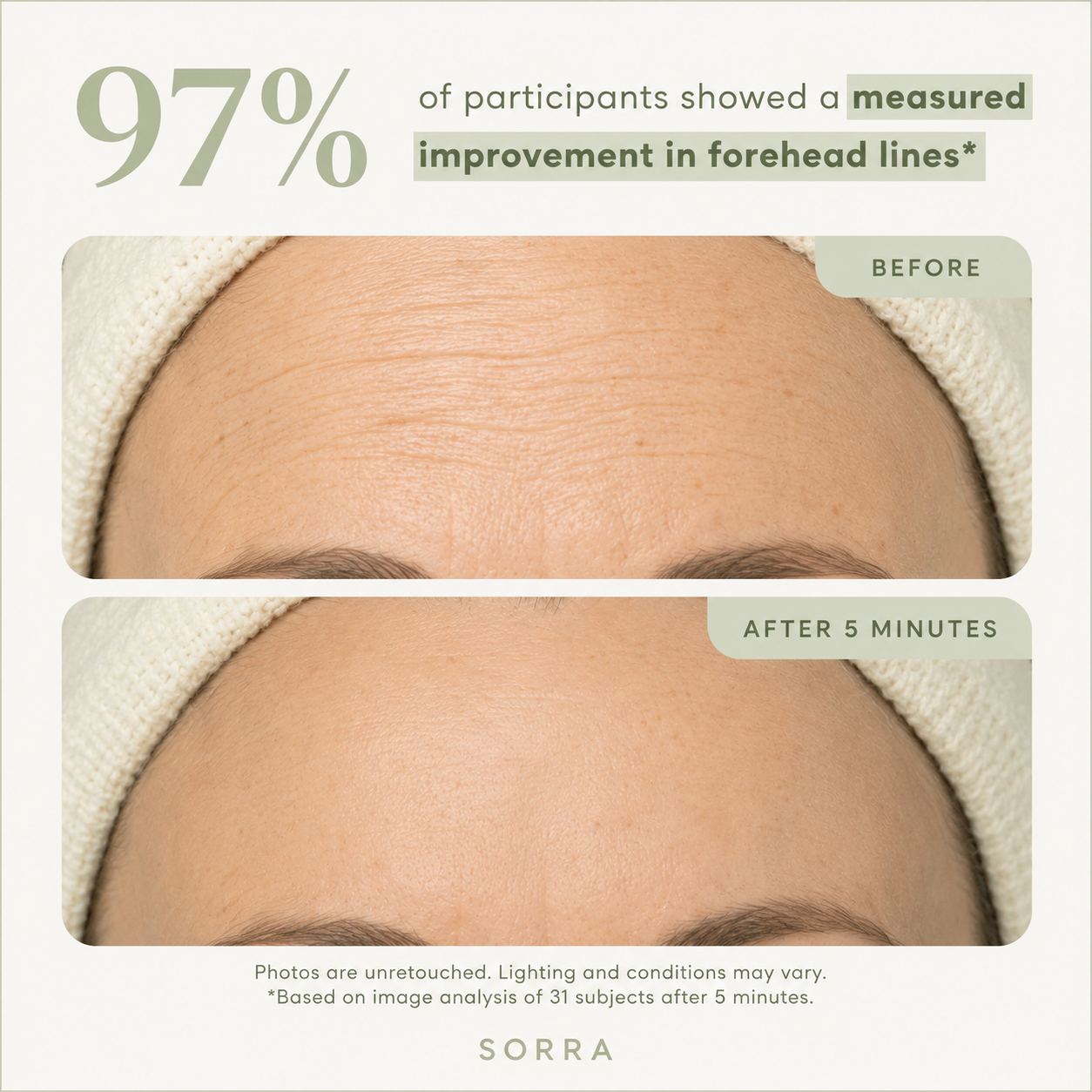 Sorra™ Eye Bag Eraser