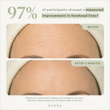 Sorra™ Eye Bag Eraser