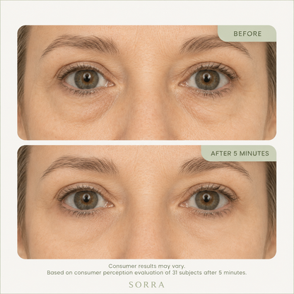 Sorra™ Eye Bag Eraser